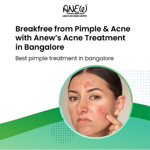 acne treatment in bangalore​